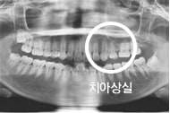 치료 전