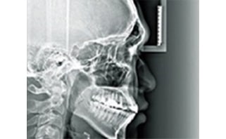 Scan Type Cephalometric