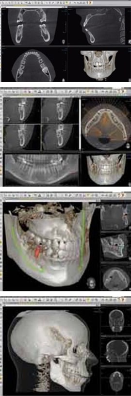 Customized 3D analysis & Simulation S/W_Ez3D2009