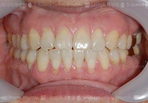 20140413020401_2_702756.jpg