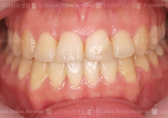 20140413020409_2_731277.JPG