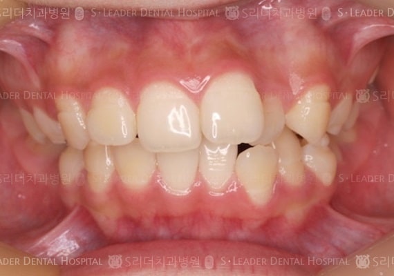 20140413020414_1_371935.JPG