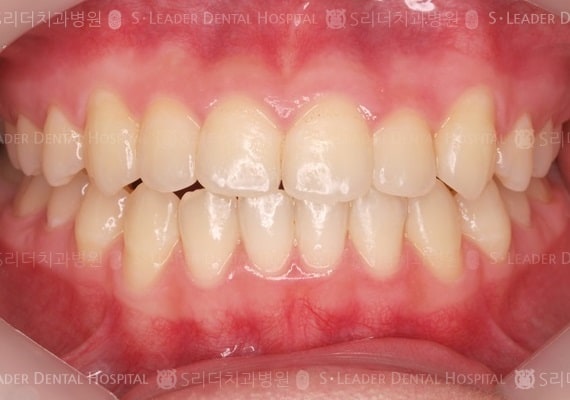 20140413020426_2_852476.JPG