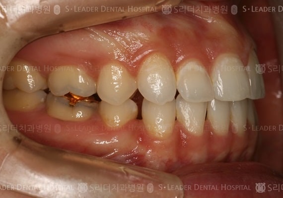 20140413020432_1_301576.jpg