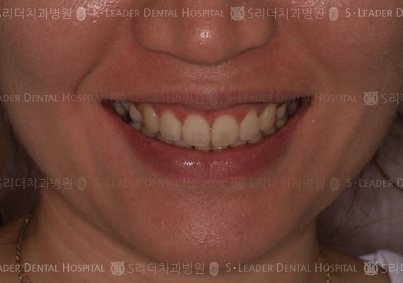 20140413020436_2_206390.JPG