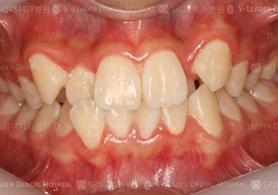 20140413020438_1_161363.jpg