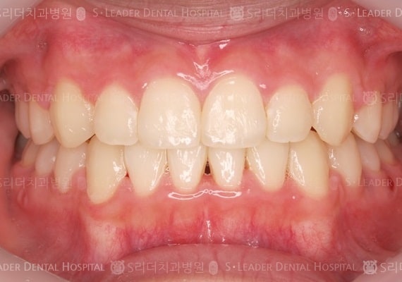 20140413020443_2_207838.JPG