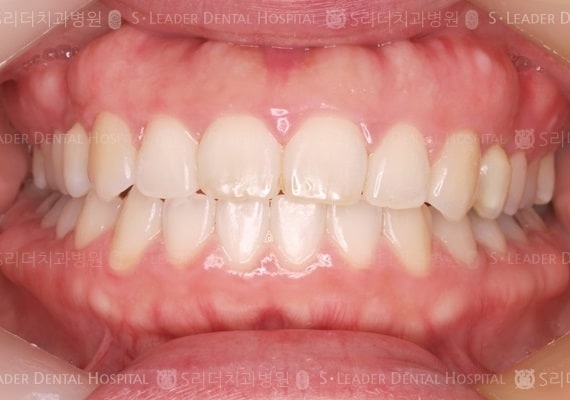 20140413020455_2_456496.JPG