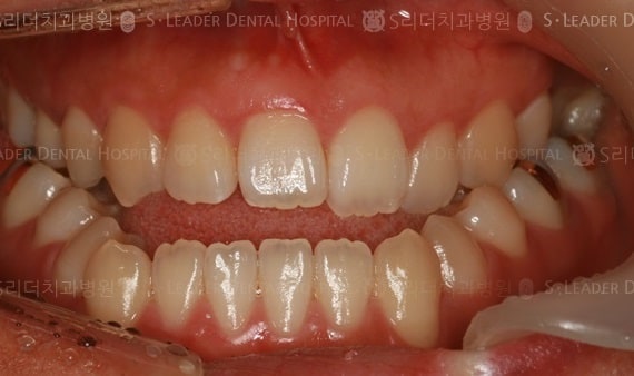 20140413030404_1_194152.jpg