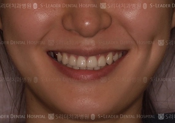 20140413030413_2_640689.JPG