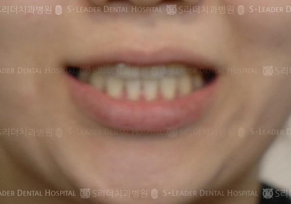 20140413030413_2_888645.JPG