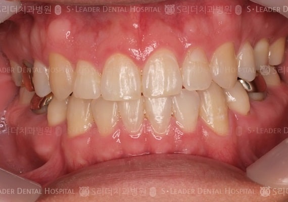 20140413030419_2_285262.JPG