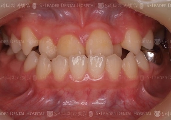 20140413030426_1_443796.JPG