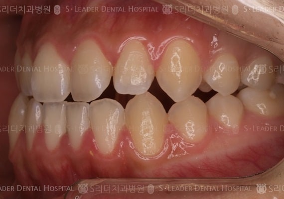 20140413030430_1_590546.JPG