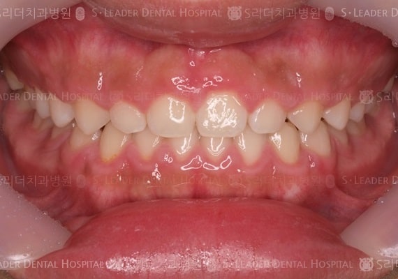 20140413030434_2_531771.JPG