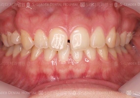 20140413030435_1_341483.JPG