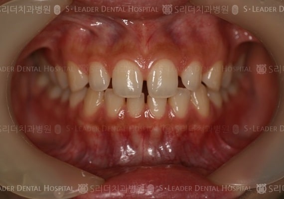 20140413030436_1_846876.jpg