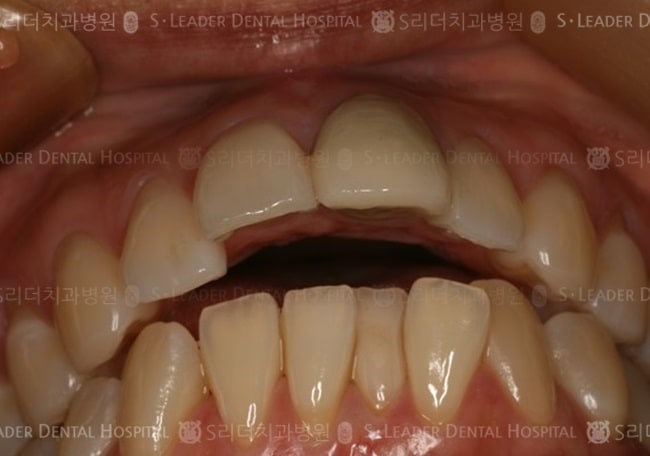 20140413030445_1_479379.jpg