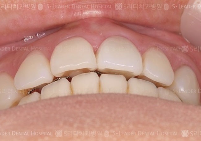 20140413030445_2_808336.JPG