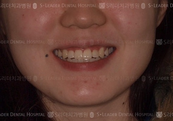 20140413030450_2_388460.JPG