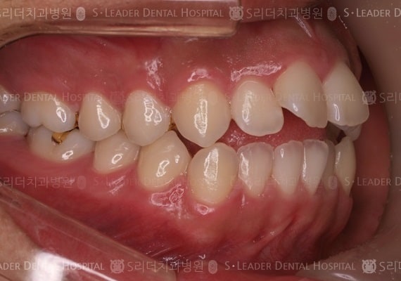 20140413030452_1_802569.JPG