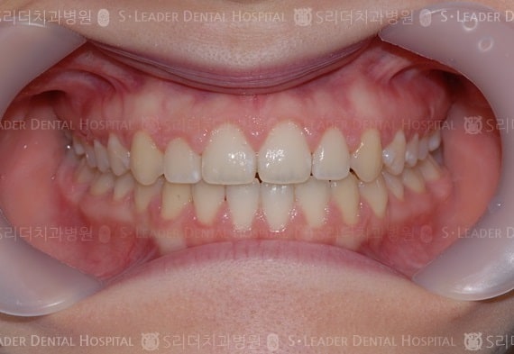 20140413030455_2_837060.jpg