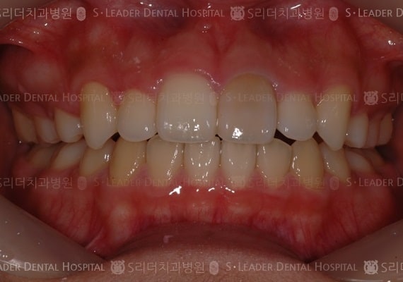 20140413040432_2_298664.JPG