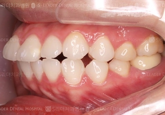 20140413040448_1_407665.JPG