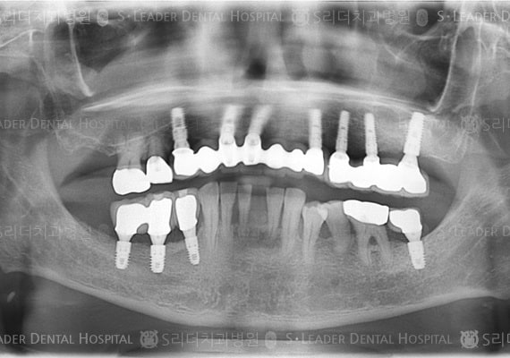 20140424070426_2_719037.jpg
